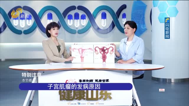 20250617《健康山东》：子宫肌瘤一定要手术切除吗？