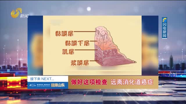 20250731《健康山东》：做好这项检查 远离消化道癌症