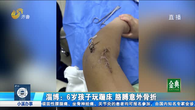 淄博：6歲孩子玩蹦床意外骨折 賠償責任如何認定？