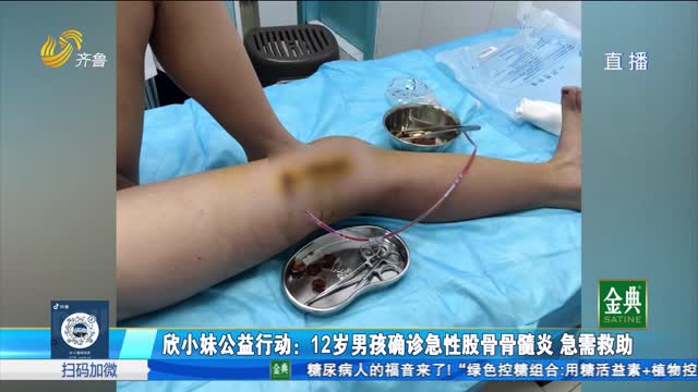 欣小妹公益行动：12岁男孩确诊急性股骨骨髓炎 急需救助