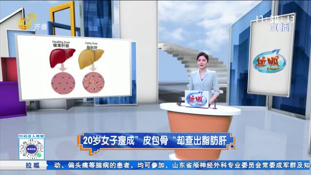 拉呱秀：20岁女子瘦成“皮包骨” 却查出脂肪肝